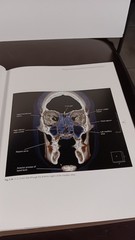 COLOR ATLAS OF CONE BEAM VOLUMETRIC IMAGING FOR DENTAL APPLICA TIONS Dale Miles