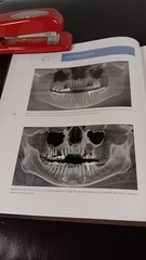 COLOR ATLAS OF CONE BEAM VOLUMETRIC IMAGING FOR DENTAL APPLICA TIONS Dale Miles