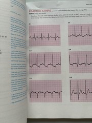 Basic Arrhythmias With 12-Lead EKGs Gail Walraven 2016 Paperback Eighth Edition