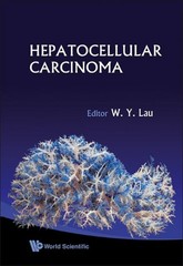 NEW: HEPATOCELLULAR CARCINOMA 1st Edition HARDCOVER 2008