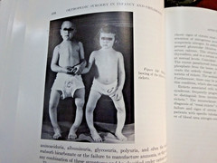 The Surgery of Infancy and Childhood 1963 Hard Cover with index 650 pages