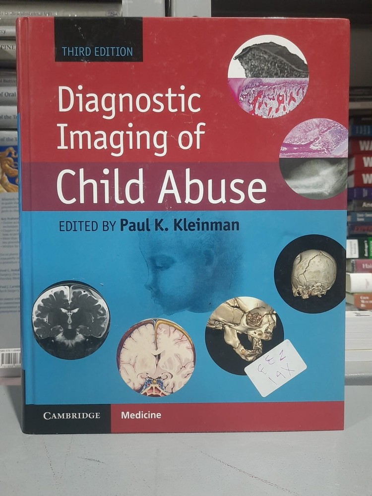 Diagnostic Imaging of Child Abuse